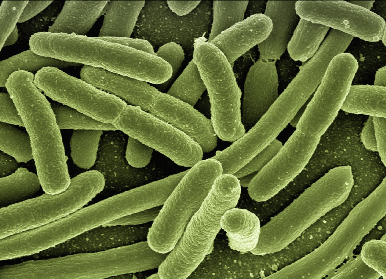 Escherichia coli (E. coli) bacteria culture
